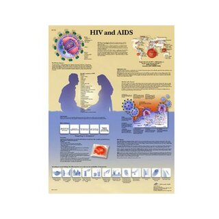 Undervisningsplansch HIV och AIDS, laminerad 50x67 cm (engelsk)