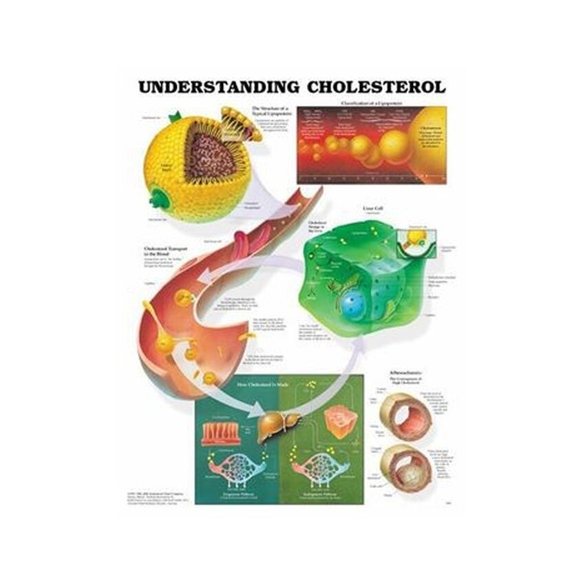 Undervisningsplansch Kolesterol och lipoproteiner, laminerad 51x66 cm