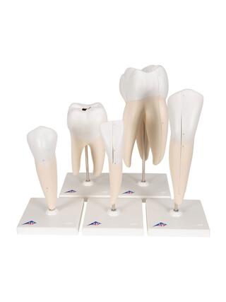 5 förstorade och olika tänder (inkl. karies) presenterade på separata stativ