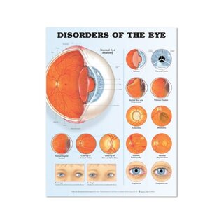 Ögonsjukdomar laminerad affisch (Disorders of the Eye)