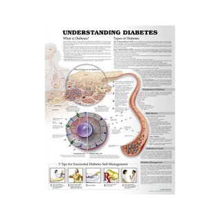Diabetes – engelsk undervisningsplansch 51x66 cm