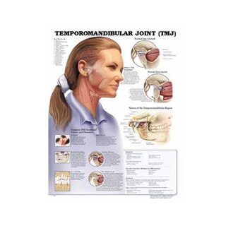 Temporomandibulär ledsjukdom (TMJ) laminerad engelska