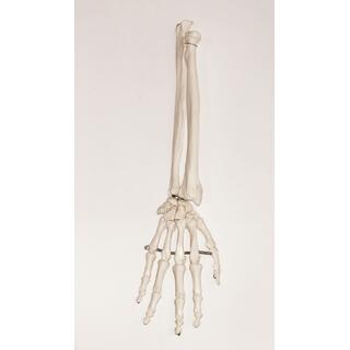Modell av handens skelett samt båda underarmsbenen