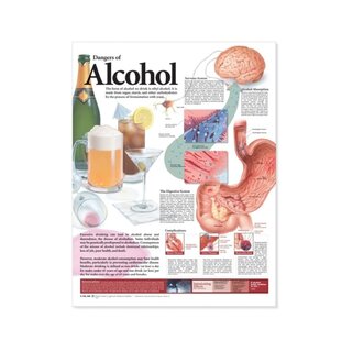 Laminerad affisch på alkoholens skadliga effekter på engelska