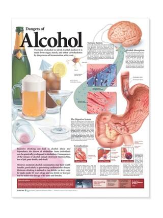 Laminerad affisch på alkoholens skadliga effekter på engelska