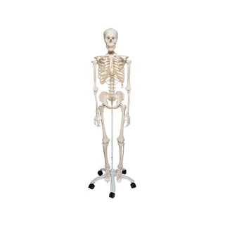 Extra robust skelettmodell